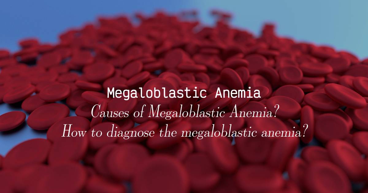 Megaloblastic Anemia